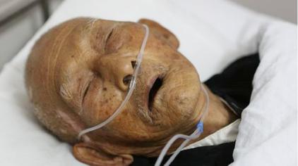 老人临终前三个月表现 - 西瓜视频