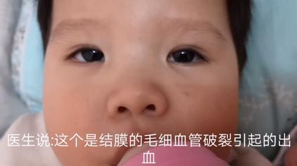 眼睛周围起红点图片 西瓜视频